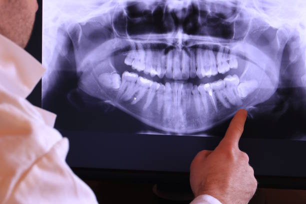 Professional Emergency Dental Service in MO