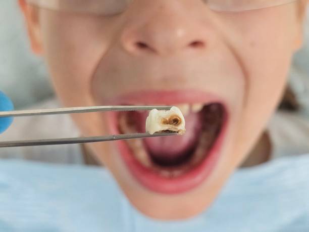 Best 24-Hour Emergency Dental Care in Black Jack, MO